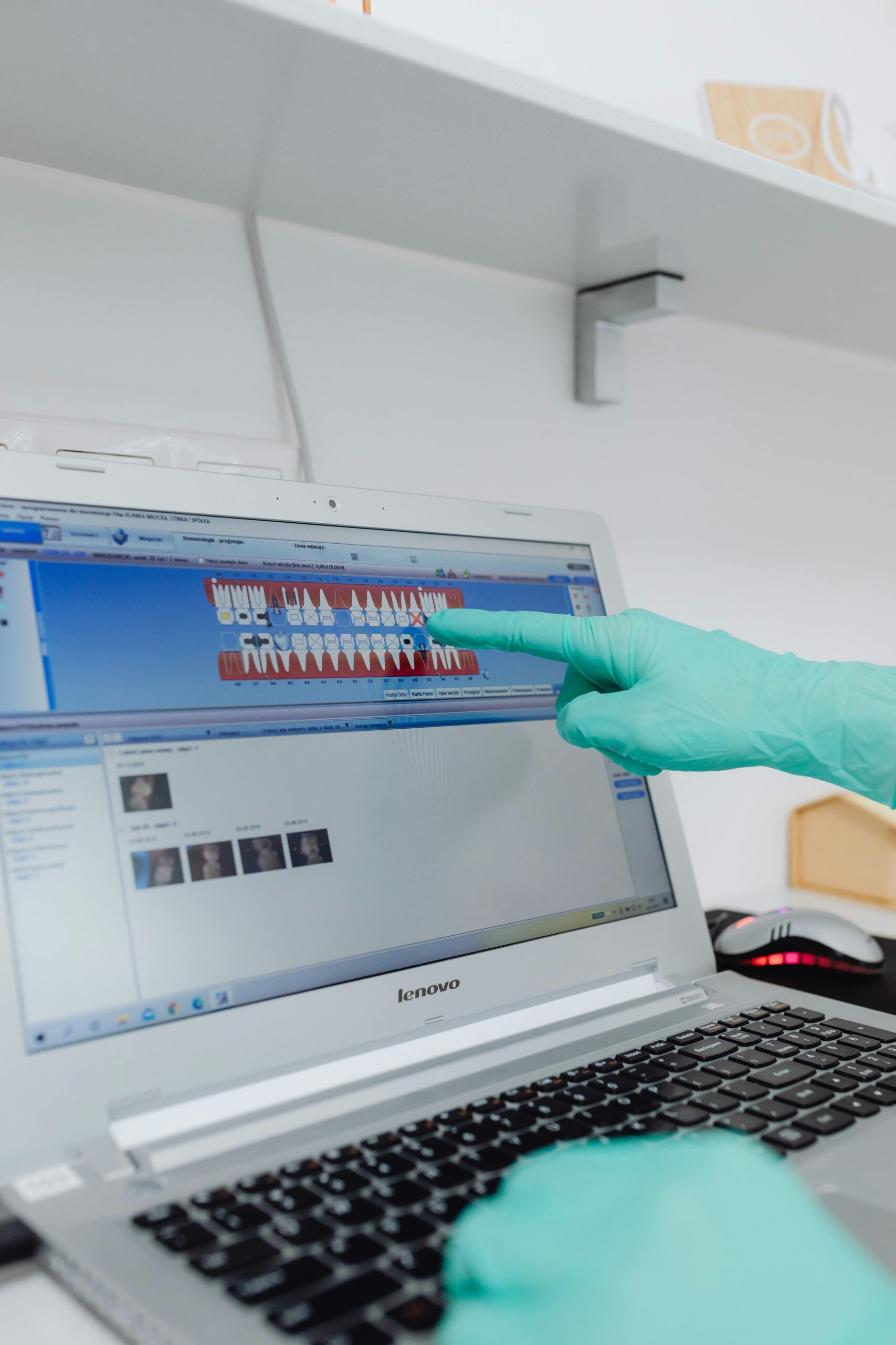 Gloved hand pointing at dental chart on a Lenovo laptop screen in a clinical setting.